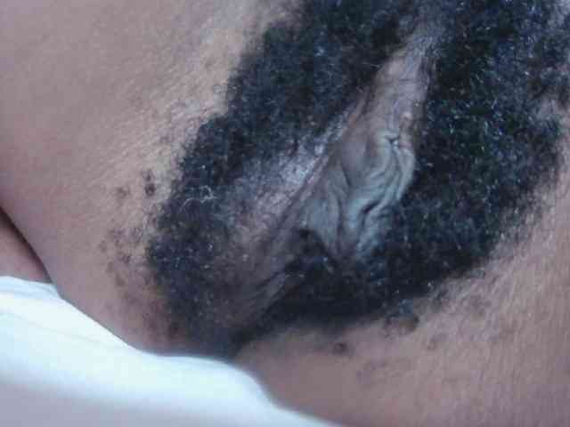 Skinybitchx Skinybitchx