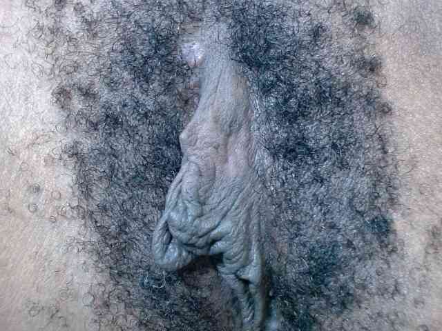 Skinybitchx Skinybitchx