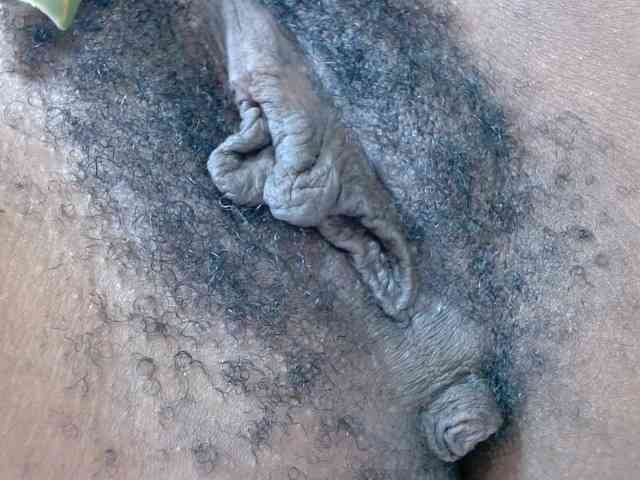 Skinybitchx Skinybitchx