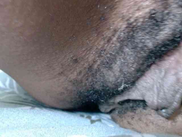 Skinybitchx Skinybitchx