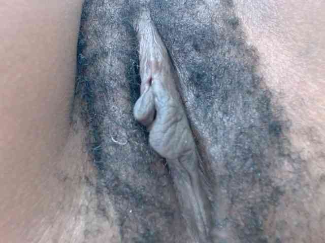 Skinybitchx Skinybitchx