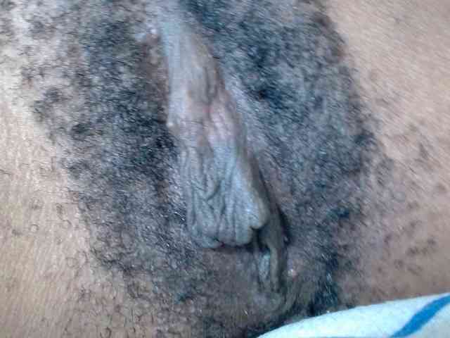 Skinybitchx Skinybitchx