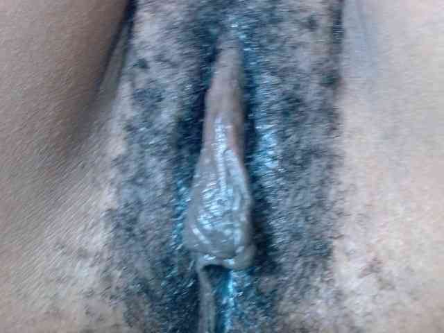 Skinybitchx Skinybitchx