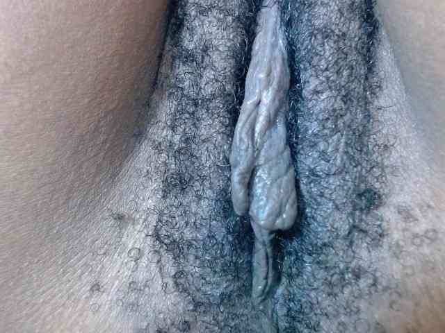 Skinybitchx Skinybitchx