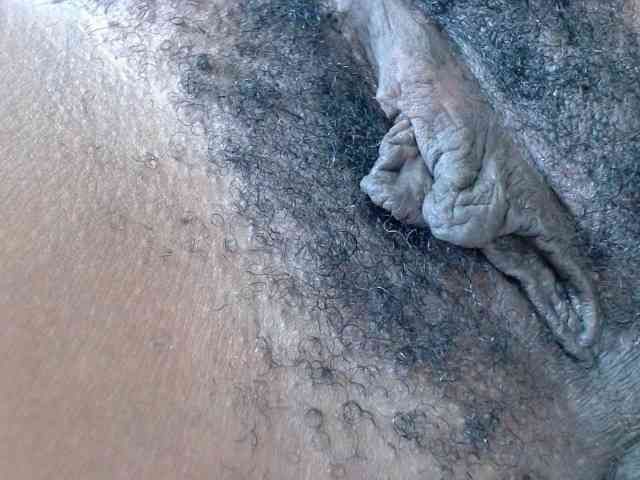 Skinybitchx Skinybitchx