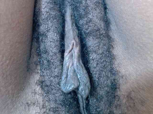 Skinybitchx Skinybitchx