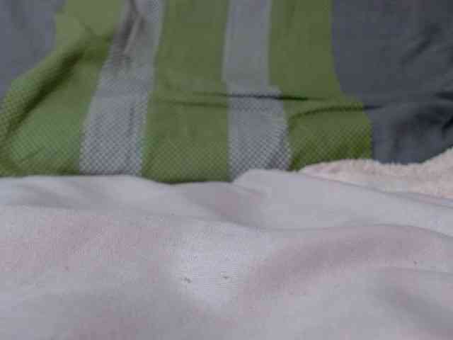 Skinybitchx Skinybitchx