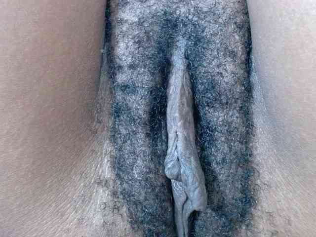 Skinybitchx Skinybitchx