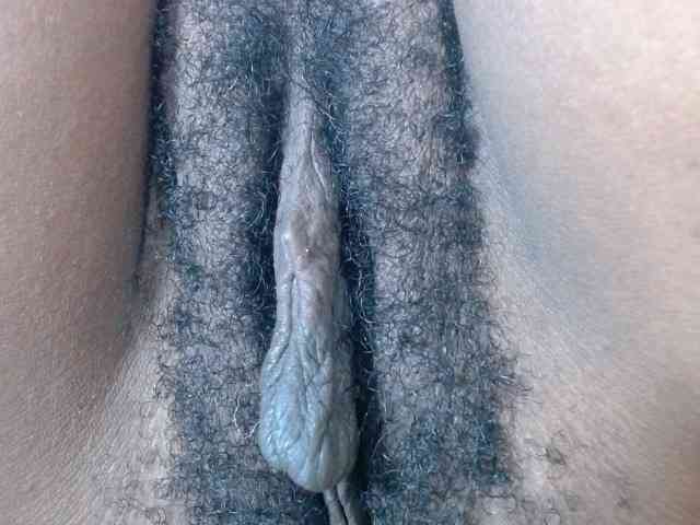 Skinybitchx Skinybitchx