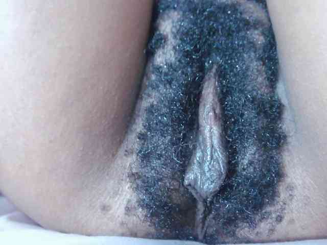 Skinybitchx Skinybitchx