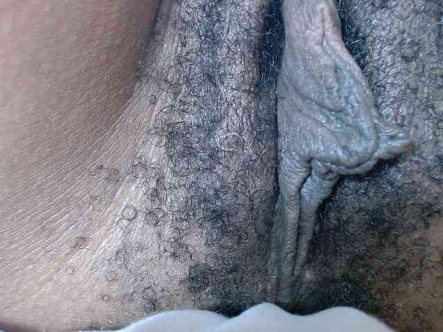 Skinybitchx Skinybitchx