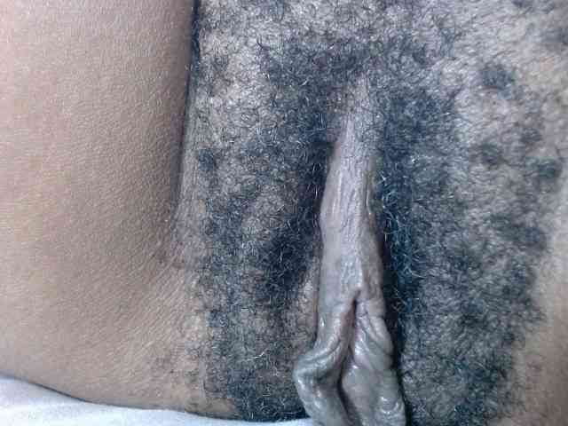 Skinybitchx Skinybitchx