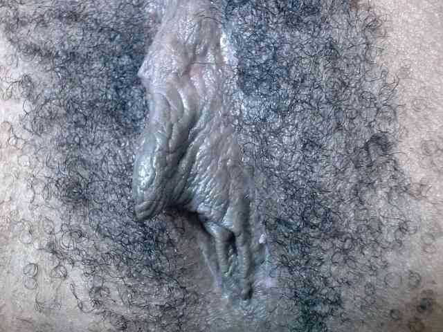 Skinybitchx Skinybitchx