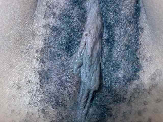 Skinybitchx Skinybitchx