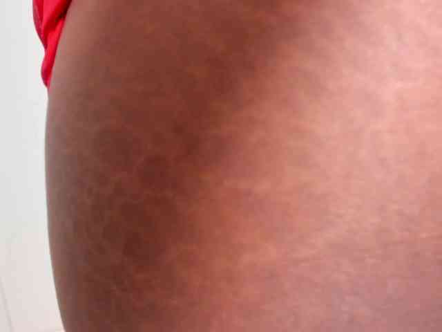 Kenia-Storm Kenia-Storm