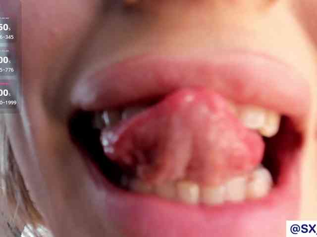 IceStrawberry webcam