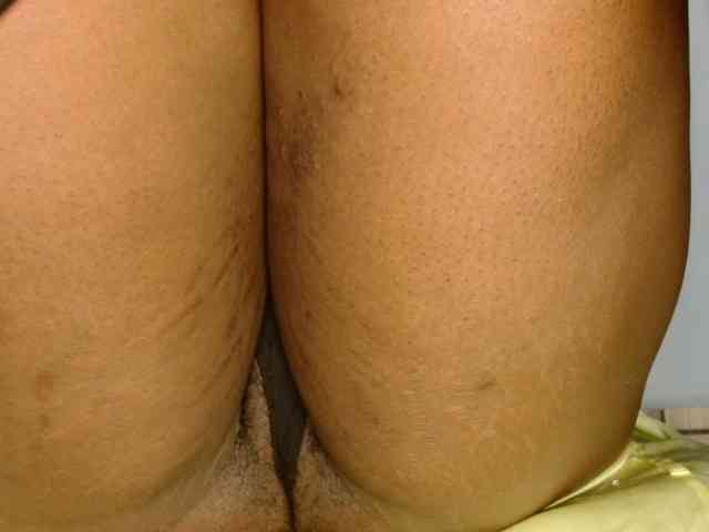 Dirtydesire Dirtydesire