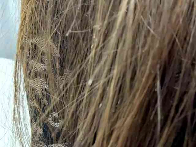 VernieWhitcher webcam