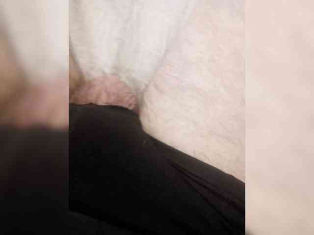 MicroPenis-1 MicroPenis-1