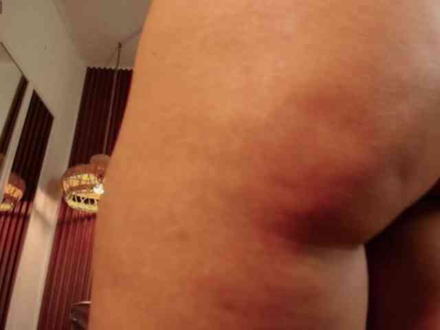 Alice-blaker Alice-blaker