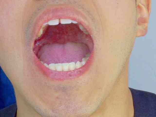 Jeickclark Jeickclark