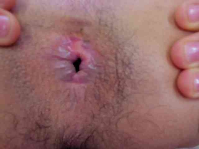 AxelMonroe AxelMonroe