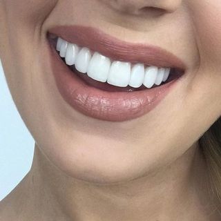 Зубные импланты