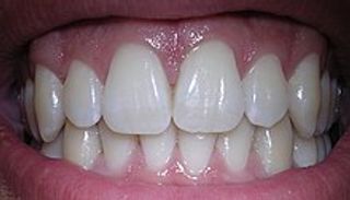 Teeth