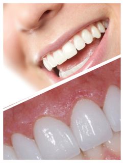 Teeth (implantation, aesthetics, necessity)