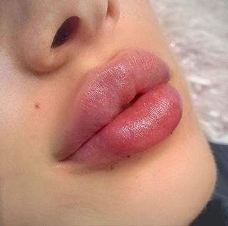 Lips
