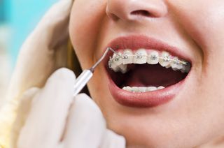 Teeth