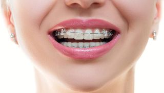 Healthy, beautiful smile