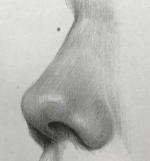 Ринопластика