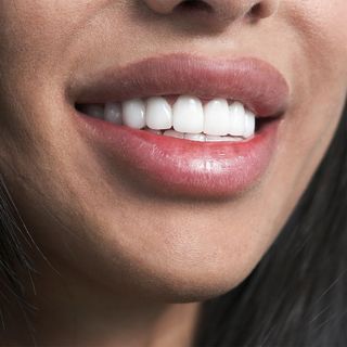 perfect teeth