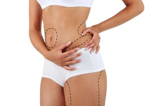 body plastic surgery