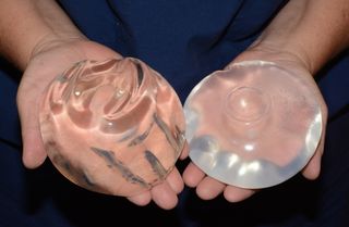 BREAST AUGMENTATION