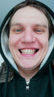 Tooth