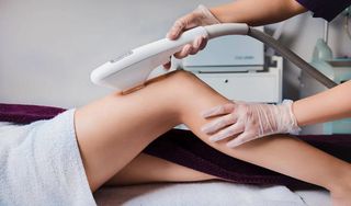 I want to do laser hair removal