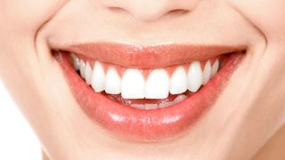 Smile design ?